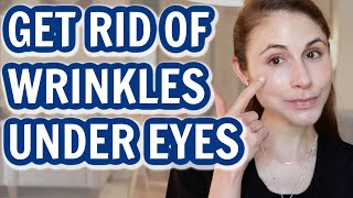 How to GET RID OF UNDER EYE WRINKLES Dr Dray [upl. by Idnak148]