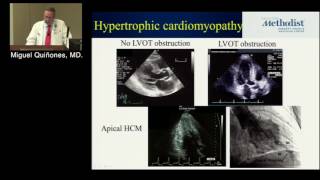 Cardiomyopathies Role of EchoMRICT Miguel Quinones MDDipan Shah MD February 7 2017 [upl. by Euqilegna]