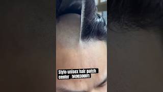 Full natural hair patch one month life [upl. by Akcirderf26]