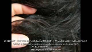 Extension de Cheveux Dépose Catastrophe [upl. by Enelak]