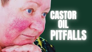 9 Common Castor Oil Pitfalls You Should never make [upl. by Enilauqcaj702]