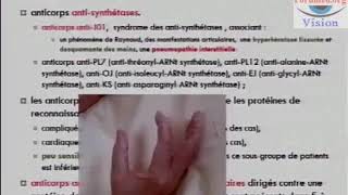 Les Myopathies inflammatoires Polymyosite et Dermatomyosite 480p 25fps H264 128kbit AAC [upl. by Sadler]