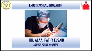 Endotracheal Intubation 7 Steps for Easy intubation [upl. by Towrey]