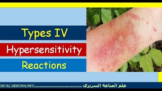 Lecture 7 Type IV Hypersensitivity Reaction [upl. by Horodko37]