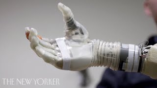 A Robotic Arm Controlled by the Mind  The New Yorker [upl. by Comstock527]