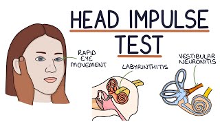 The Head Impulse Test [upl. by Yraeg829]