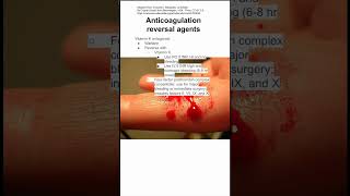 Anticoagulation reversal agents [upl. by Nnayram662]