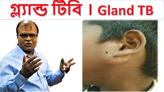 গ্ল্যান্ড টিবি । Gland TB । Homoeopathic treatment । Dr Md Abdul Mannan [upl. by Kariotta]