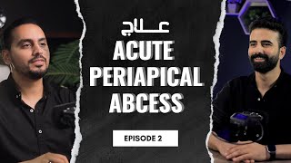 كيفية التعامل مع ال acute periapical abscess [upl. by Sachi375]