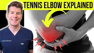 Doctor explains TENNIS ELBOW lateral epicondylitis  Symptoms causes amp treatment [upl. by Winser155]