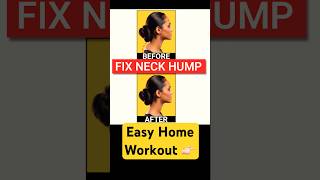 Fix Neck Hump at Home  Neck Pain Relief Exercises shorts youtubeshorts gymnoughtfitness [upl. by Sparrow487]