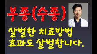 심장 부종신장콩팥성 부종 살벌한 치료법 살벌한 효과를 체험하세요민족의술 [upl. by Peppy]