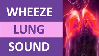 Wheezing Lung Sound Audio High Pitch  Nursing Adventitious Lung Sounds NCLEX Review [upl. by Hu751]