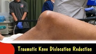 Traumatic Knee Dislocation ReductionQuick Version [upl. by Aiek]