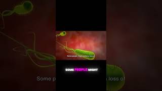 Symptoms of H Pylori Infection What to Watch For [upl. by Emyam]