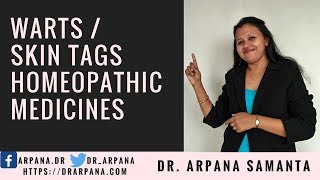 Different Types Of Warts Or Skin Tags मस्सा तिल amp How To Treat With Homeopathic Medicines [upl. by Langsdon]