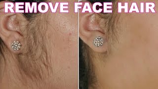 How To Remove Facial Hair Naturally  SkinCare Home Remedy  ShrutiArjunAnand [upl. by Honoria666]