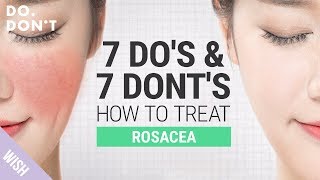 14 Tips for Rosacea That Really Work  Effective Skin Care Tips for Rosacea  Do amp Dont [upl. by Anniahs124]