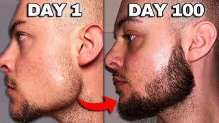 I Used Minoxidil On My Beard For 100 Days Before  After Results [upl. by Rothstein]