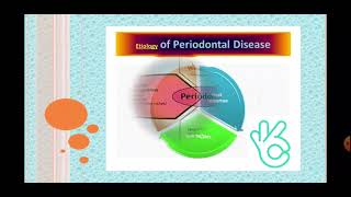 Etiology of periodontal disease Part I Dental plaque [upl. by Nnayecats]