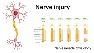 Nerve injury  Sedon and Sunderland classification of nerve injury [upl. by Trellas715]