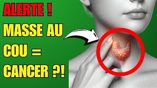 Jai Découvert Ces 5 Signes de Cancer de la Thyroïde à Ne Pas Ignorer  🚨✨ Prévention Santé [upl. by Linc307]