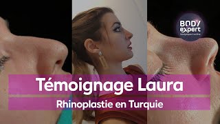 CHIRURGIE ESTHÉTIQUE  🙋🏻‍♀️Témoignage de Laura  Rhinoplastie en Turquie  BODYEXPERT [upl. by Arac]