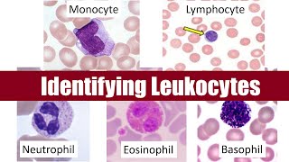 Identifying Leukocytes [upl. by Acir24]