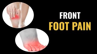 Front Foot Pain  Dr Donald Pelto  Worcester Podiatrist [upl. by Eward]