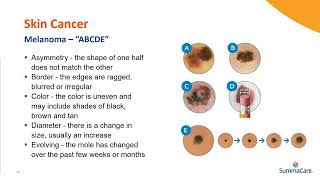 Skin Cancer Presentation [upl. by Haram792]