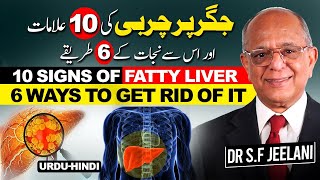 Get rid of liver fat or Fatty Liver naturally  جگر کی چربی دور کرنے کے قدرتی طریقے  हिंदी [upl. by Nitsu]