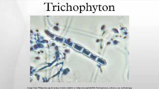 Trichophyton [upl. by Eugenides]