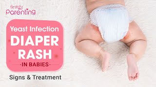 Yeast Infection Diaper Rash in Babies  Causes and Remedies [upl. by Whitehurst]