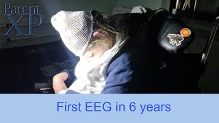 Elin has an EEG for the first time in 6 years [upl. by David]