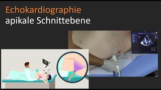 apikale Schnittebene  Echokardiographie [upl. by Hutson431]