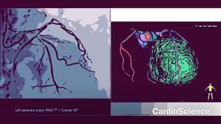 PROYECCIONES ANGIOGRAFICAS CORONARIAS EN CARDIOLOGÍA INTERVENCIONISTA [upl. by Yorick]