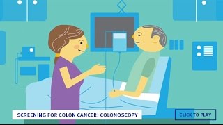 Screening for Colon Cancer Colonoscopy English [upl. by Atnom245]