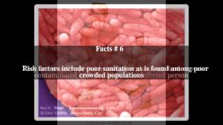 Paratyphoid fever Top  10 Facts [upl. by Radie608]