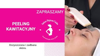 Peeling Kawitacyjny  na czym polega i jak wygląda zabieg [upl. by Eelanaj]