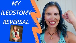 My Ileostomy Reversal Experience [upl. by Blumenfeld]