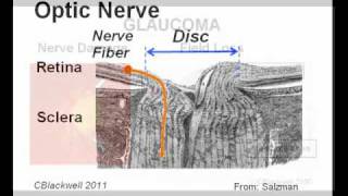 Eye Works 2 Image Retina Optic Nerve and Brain [upl. by Muldon688]