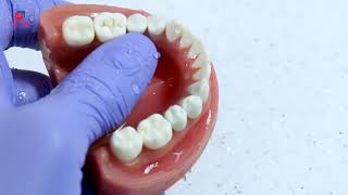 Class I simple occlusal cavity preparation short video [upl. by Nemracledairam]