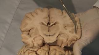 Cortical Localization Neuroanatomy Video Lab  Brain Dissections [upl. by Betti]