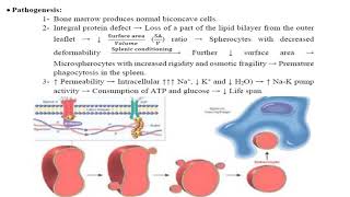 hereditary spherocytosis 1 [upl. by Terrill]