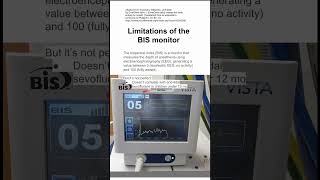 Limitations of the BIS monitor [upl. by Asiralc695]