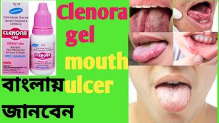 Clenora gelBenefitsSideffectsDosageজিভের ঘাঠোঁটের ঘাদীর্ঘদিন ধরে কোনো ভাবেই ভালো হয় না [upl. by Eidlog222]