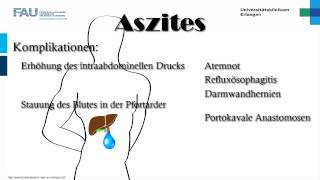 Innere Medizin ─ Aszites [upl. by Ronym]