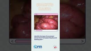 Intestinal peristalsis  OSPE amp OSCE  MBBS  NEXT  PLAB  USMLE [upl. by Yrgoerg]