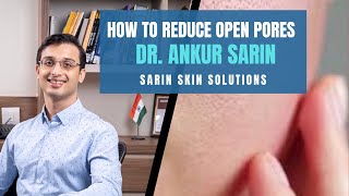 HOW TO REDUCE OPEN PORES  DR ANKUR SARIN  SARIN SKIN SOLUTIONS [upl. by Zsuedat]