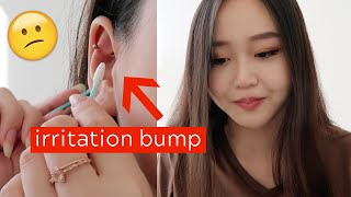 What to do about IRRITATION BUMPS Flat Cartilage Piercing 6 Months Update [upl. by Nyltyak160]